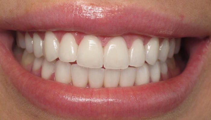 Pasta de dientes blanqueadora púrpura, 30ml, limpieza profunda, eliminación de manchas, dentifrice, aliento fresco, elementos esenciales para el cuidado bucal para la vida diaria