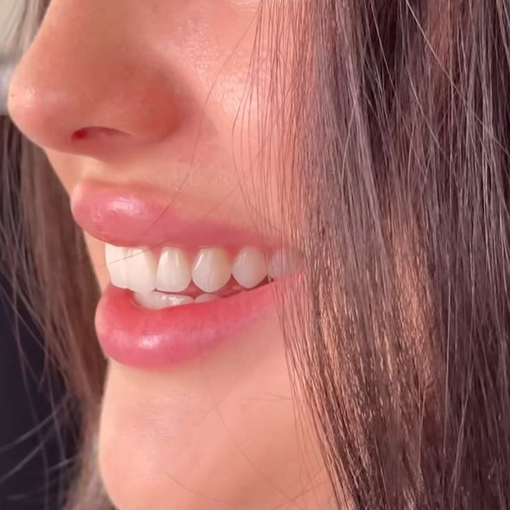 CICAPLAST Baume B5 crema Facial calma la piel sensible Centella Asiática bálsamo reparador enrojecimiento sequedad para la piel loción Facial