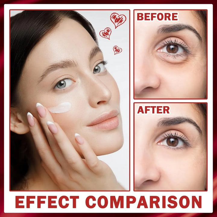 Creme de ácido Retinol e Colágeno – clareador de melasma, Firmeza, Anti-Rugas, Hidratação e Clareamento da Pele